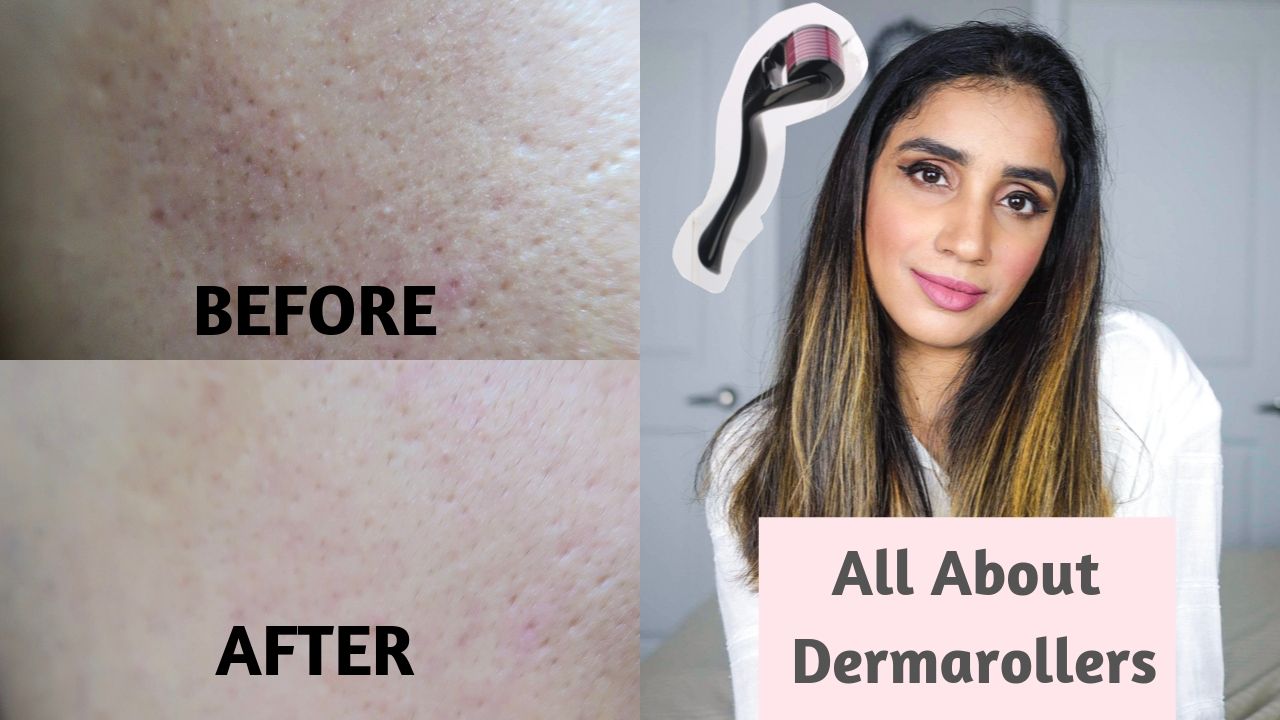 What is Derma Rollers? + How to do MicroNeedling at Home? Before and After Results